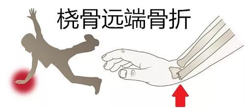 地毯拉力_地毯拉伸_地毯拉力什么意思